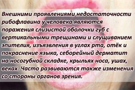 Vitamina B2 (riboflavina) - efecte asupra organismului, beneficiile și efectele negative, descrierea