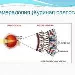 În unele cazuri, există o ceață în ochii tratamentului ochi la domiciliu (tratament) În unele cazuri, există o ceață în ochii tratamentului la domiciliu a ochilor