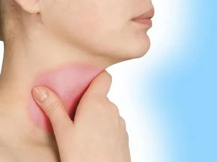 Inflamarea corzilor vocale și tratamentul simptomelor (inflamație) Inflamarea corzilor vocale simptome și tratament
