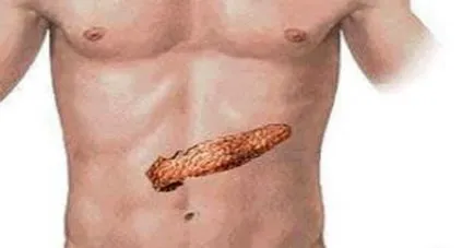 structură eterogenă pancreatic care este
