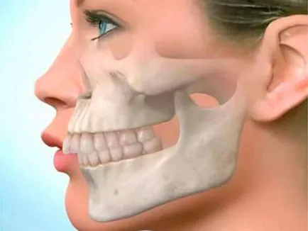 poze Overbite de toate tipurile, motivele pentru formarea de corecție (specii) poze Overbite de toate tipurile, motivele pentru formarea de corecție