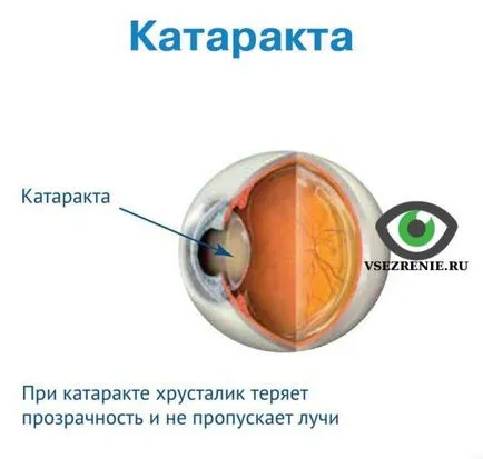 Totul despre viziune