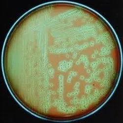 Staphylococcus aureus remedii populare de tratament
