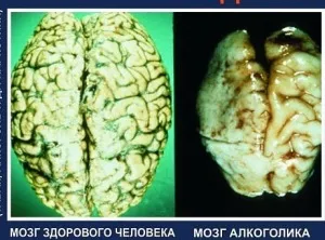 Ca o bere de băut auto iesi