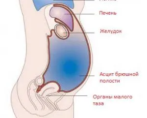 Din care fluidul în abdomen
