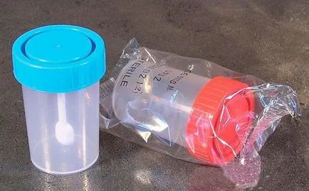 Cum de a colecta fecale la sugari