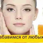 Tratamentul de remedii populare pentru gusa