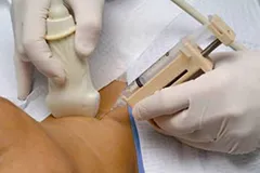 biopsie ac a glandei tiroide