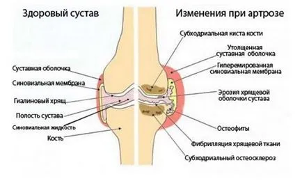 genunchi Sore decât vindecarea