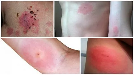 Decât pentru a trata ploșniță musca Decât pentru a trata ploșniță musca