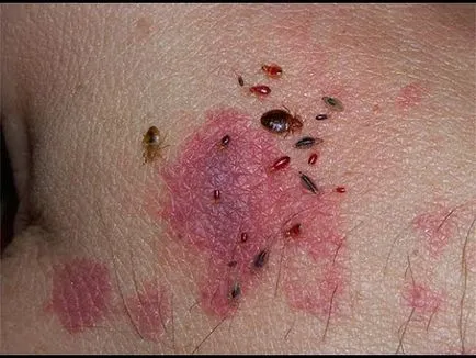 Decât pentru a trata ploșniță musca Decât pentru a trata ploșniță musca