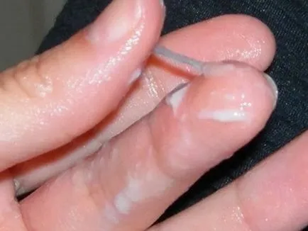 Toate ureaplasmosis tratament