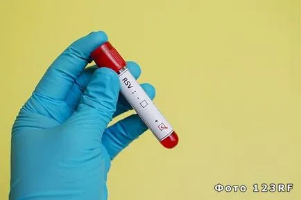 Tulpinile de microorganisme care aceasta este