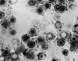 Herpes la bărbați și cum Herpes la bărbați și cum