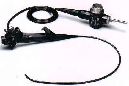 Hysteroresectoscopy ce este Hysteroresectoscopy ce este