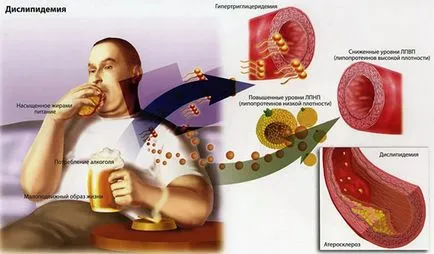 Cum de a trata ischemie