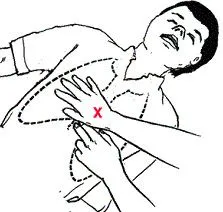 Cum de a corecta masaj cardiac