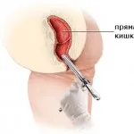 Verificarea gut Verificarea gut