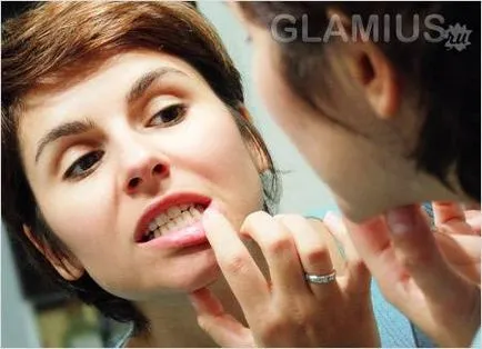 Cum sa scapi de sangerarea gingiilor