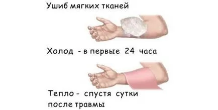Ce ajută echimoze Ce ajută echimoze