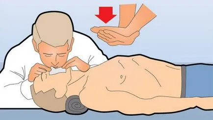 Cum de a corecta masaj cardiac