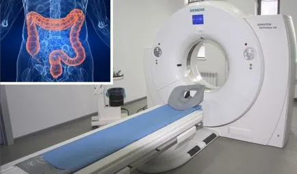 Verificarea gut Verificarea gut