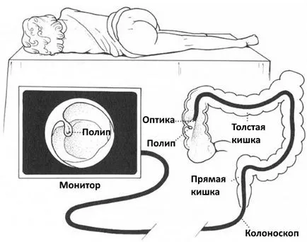 Verificarea gut Verificarea gut
