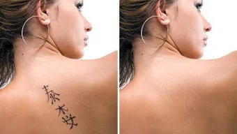 Cum de a reduce tatuaj
