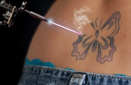 Cum de a reduce tatuaj