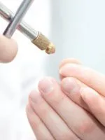 degetul Umflate pe de o parte pentru nici un motiv (deget) degetul Umflate pe de o parte pentru nici un motiv