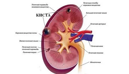 Tratamentul de rinichi la copii Tratamentul de rinichi la copii