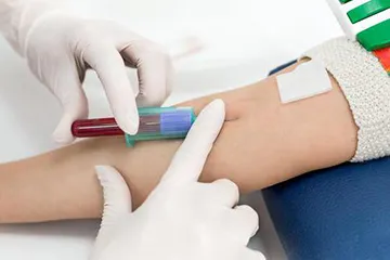 Cum să treacă testele ale glandei tiroide