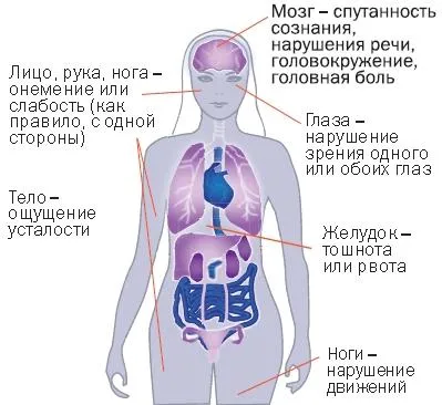 Cerebral tratament tulburări circulatorii
