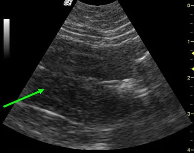 ileus la pisici ileus la pisici