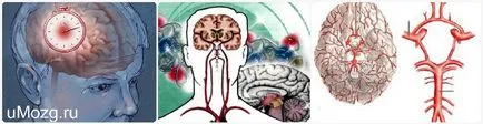 Cerebral tratament tulburări circulatorii