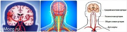 Cerebral tratament tulburări circulatorii
