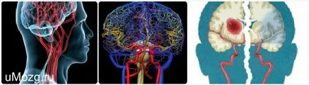 Cerebral tratament tulburări circulatorii
