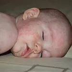 Analiza biochimică a sângelui la rata copilului