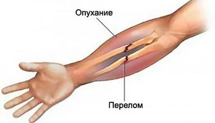 Umflarea cauzele mâinilor