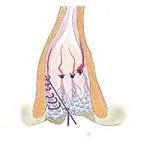 tratamentul chirurgical
