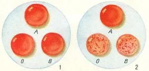 Ce determină grupa de sânge