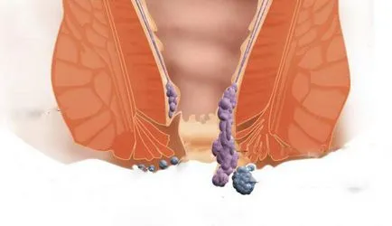 tratamentul chirurgical