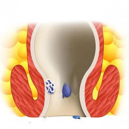 tratamentul chirurgical