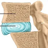 Care sunt semnele osteocondrozei