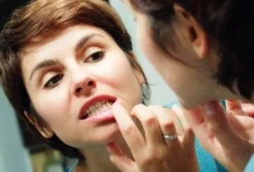 istoricul medical Parodontita istoricul medical Parodontita