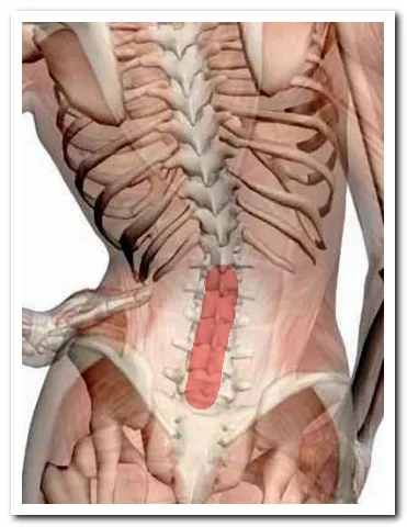 Tratamentul coloanei vertebrale lombare sacral Tratamentul coloanei vertebrale lombare sacral