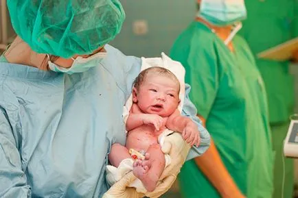 Ce ai nevoie la spital pe Cezariana