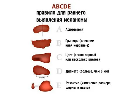 Birthmark sângerează care fac