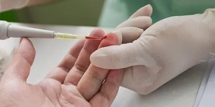 Cum de a îmbunătăți rata de sedimentare în analizele Cum de a îmbunătăți rata de sedimentare în analizele