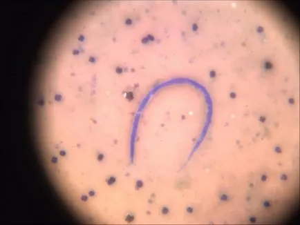 Simptomele de viermi intestinali la pisici Simptomele de viermi intestinali la pisici